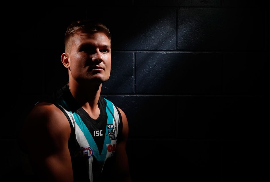 Wines in serious R1 doubt after shoulder surgery