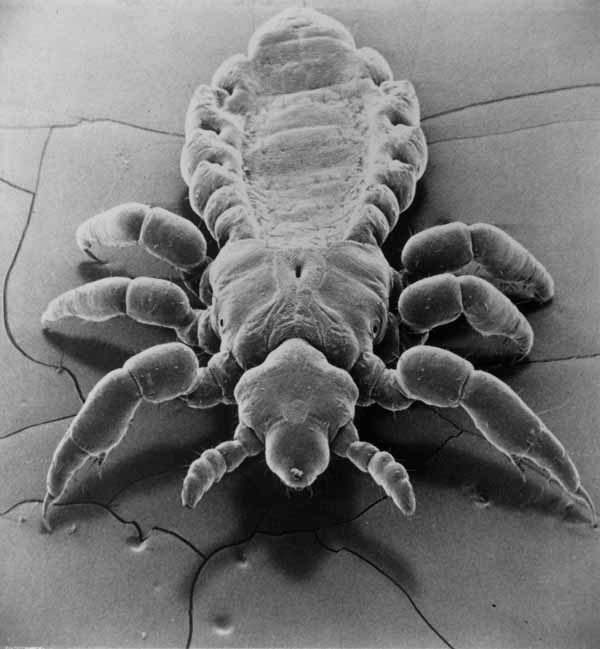 A headscratcher Lice treatment turns into Houston business