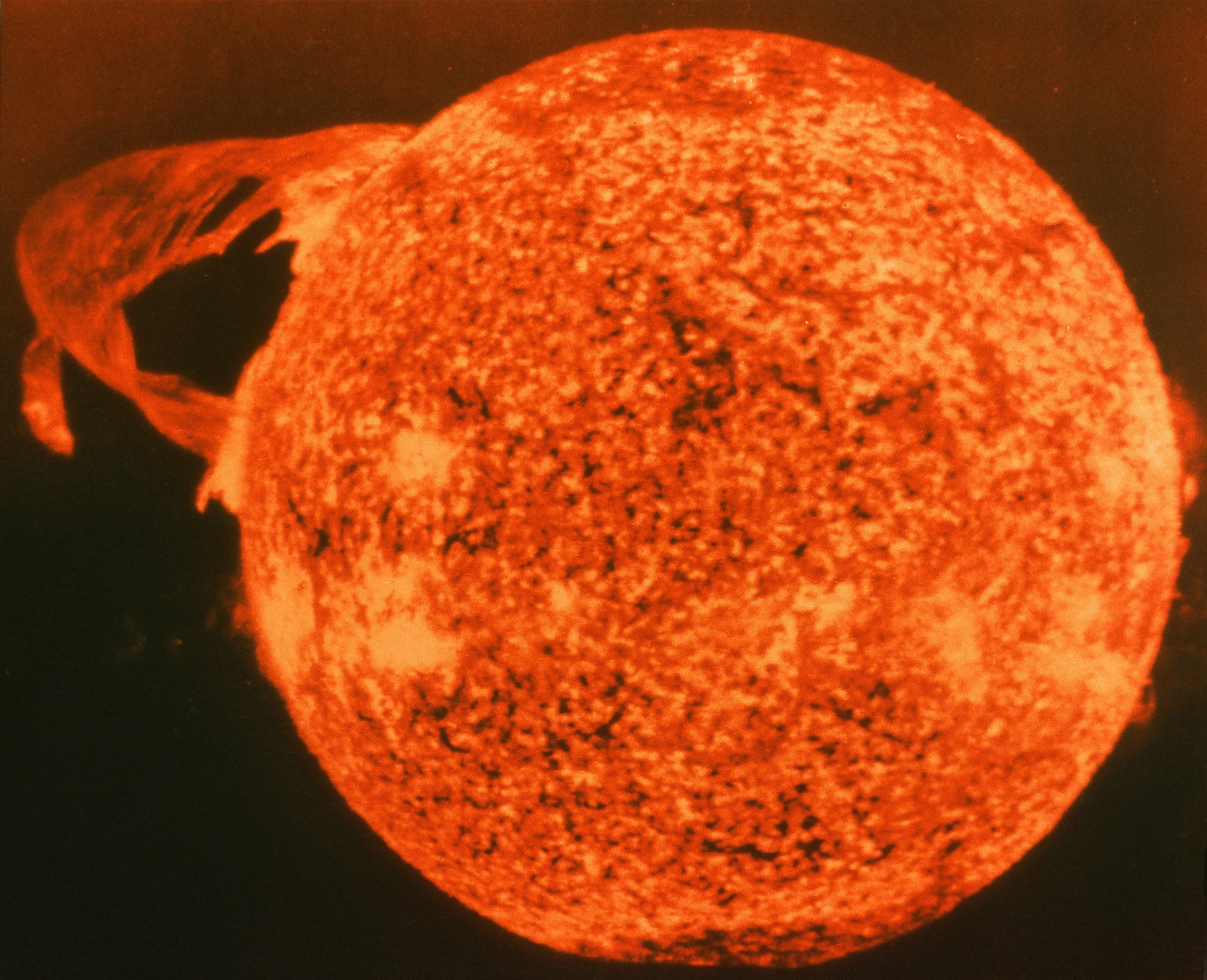 Scary Secret Sun Damage Revealed!