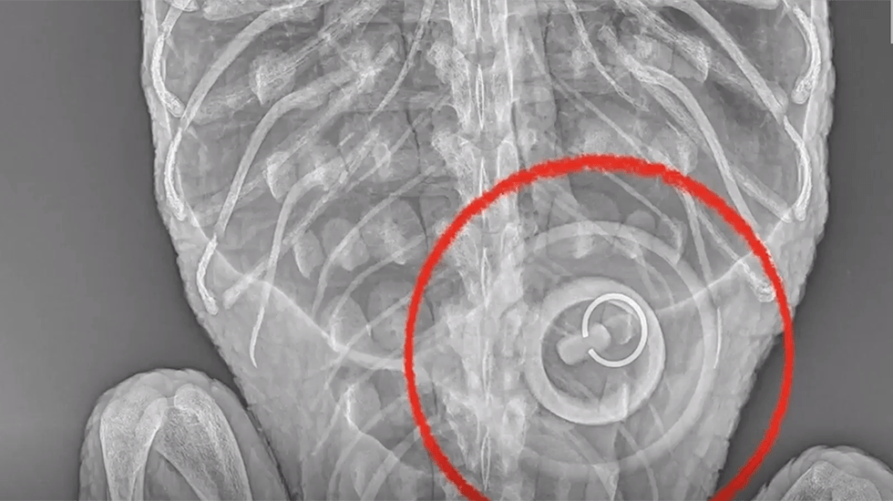 Guess What Staff Found In The XRay Of The Alligator Found In New York