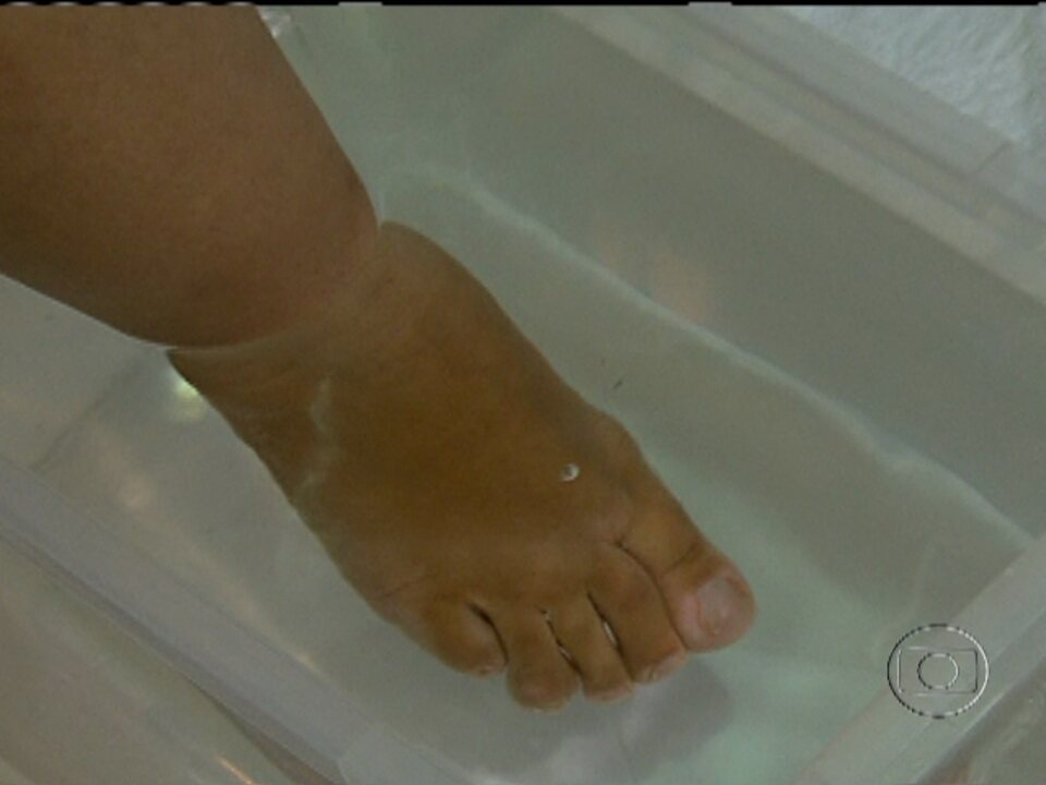 Bem Estar Teste mostra o quanto os pés incham ao longo do dia Globoplay