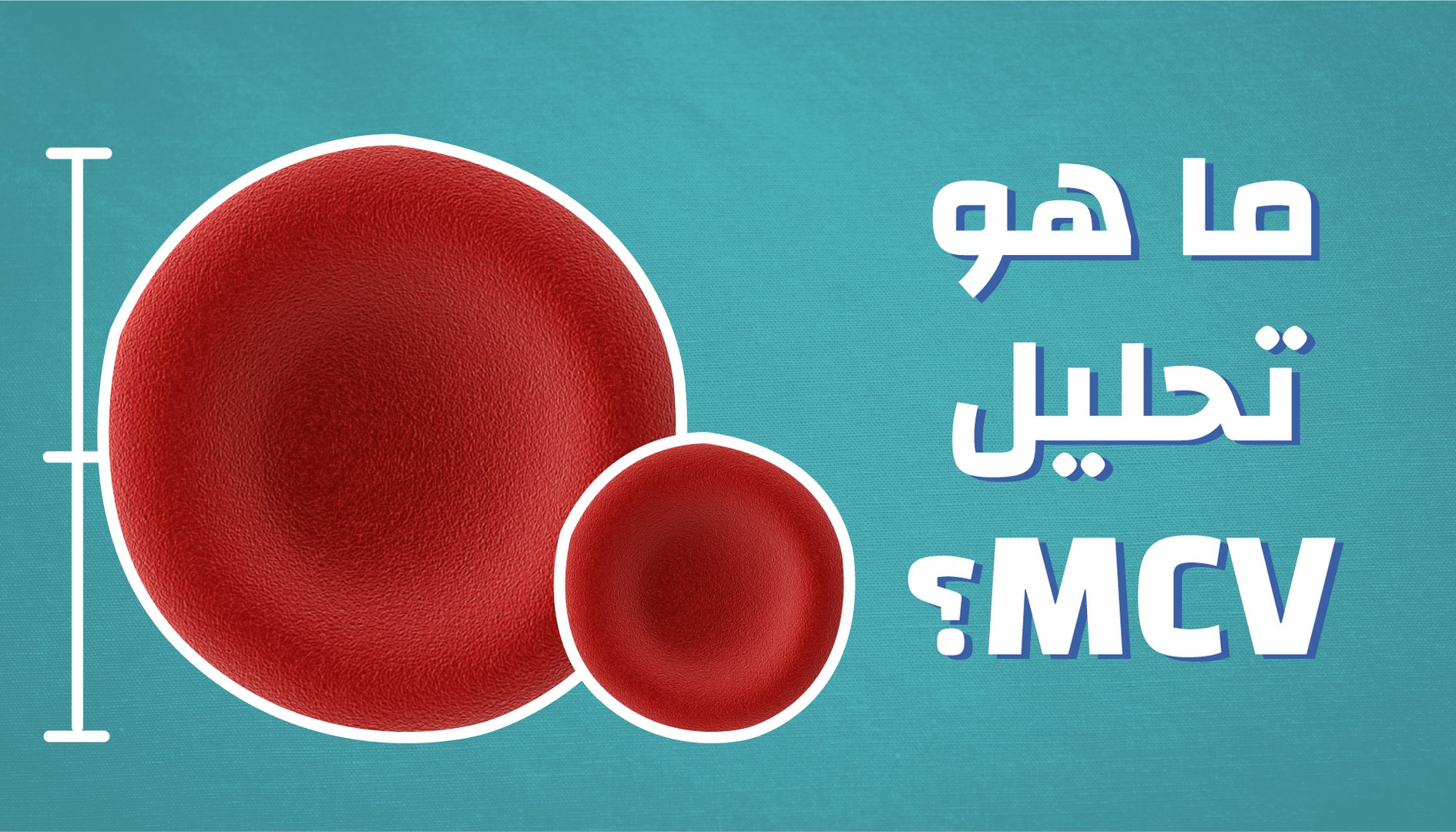 ما هو Mcv ووردز