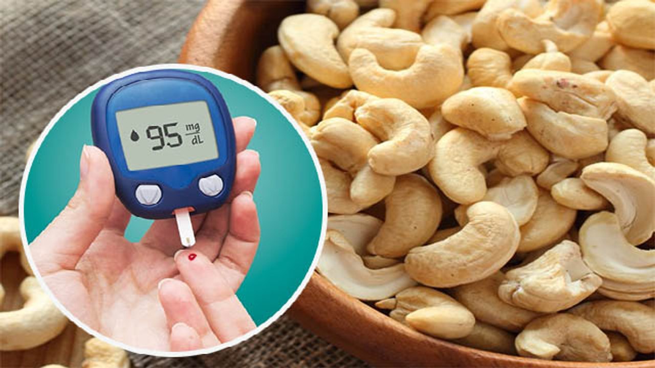 Diabetes Patients के लिए Cashews खाने के जबरदस्त फायदे, जाने क्या है