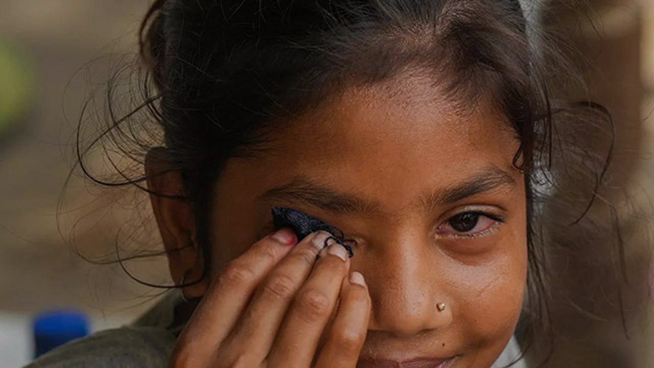 Eye Flu Kitne Din Me Thik Hota H Eye Flu Kitne Din Tak Rehta Hai