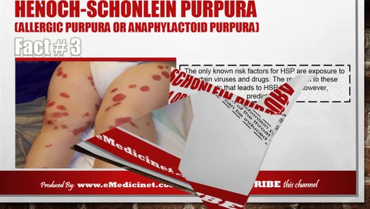 HenochSchonlein Purpura (Allergic Purpura or Anaphylactoid Purpura