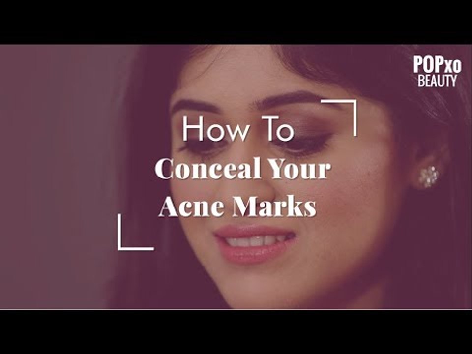How To Cover / Hide Acne Marks & Scars With Makeup POPxo Beauty