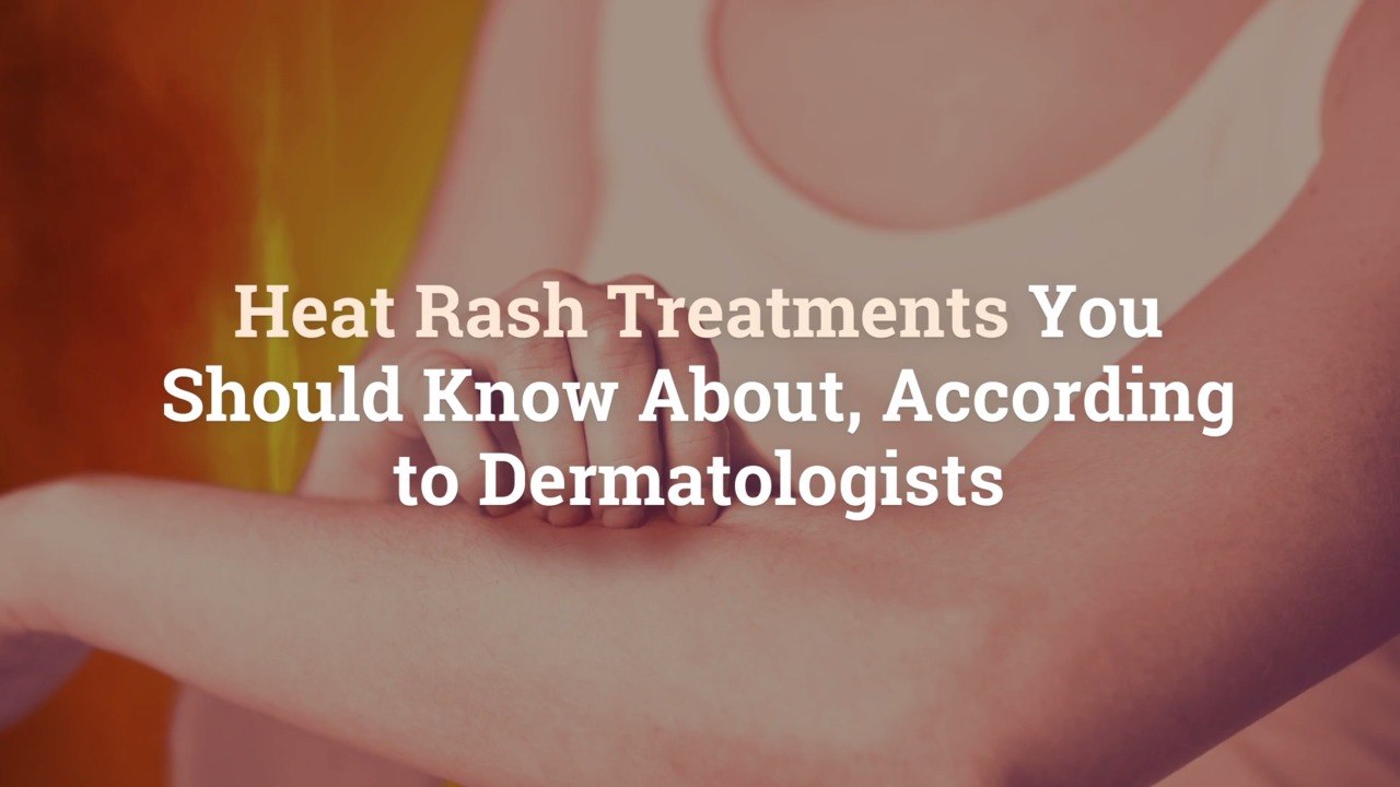 Heat Rash Treatments You Should Know About, According to Dermatologists video Dailymotion