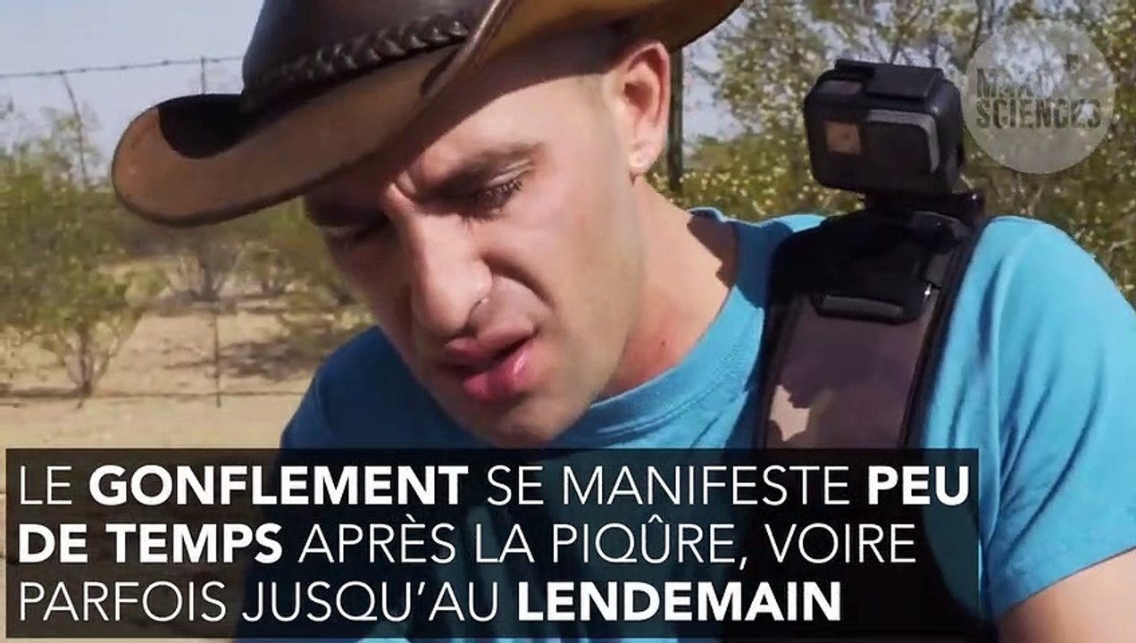 Piqûre d’abeille gonflement, que faire pour dégonfler et remède