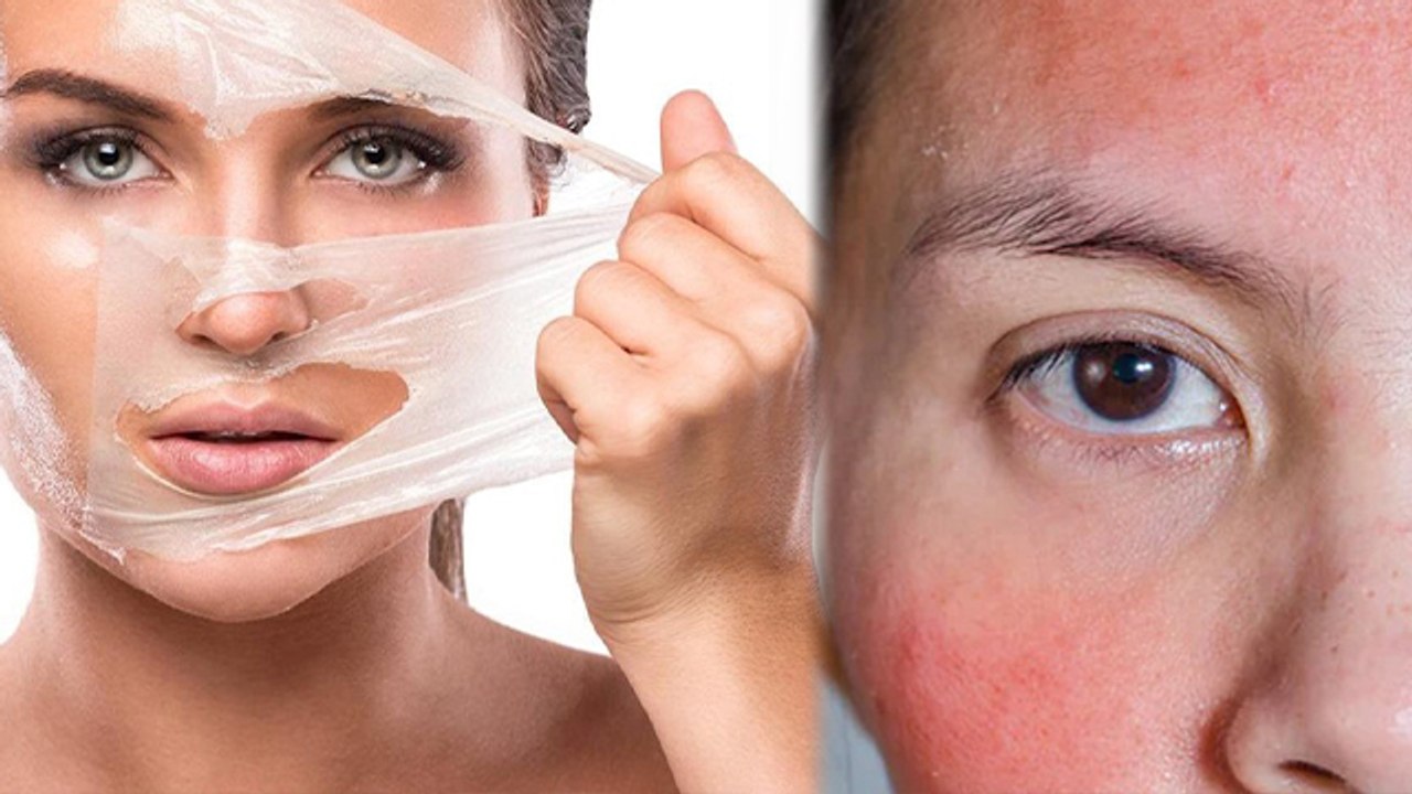 Face पर Peel Off Mask लगाने के नुकसान Face Par Peel Off Mask Lagane