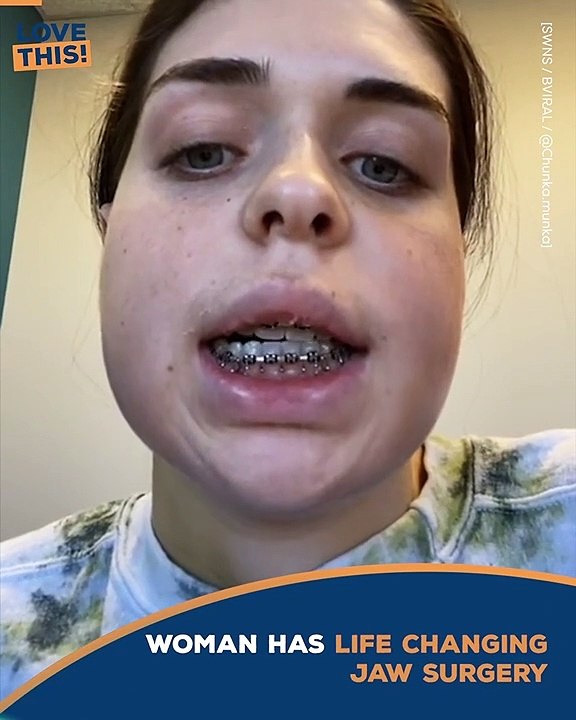 Jawdropping life changing surgery !!! video Dailymotion