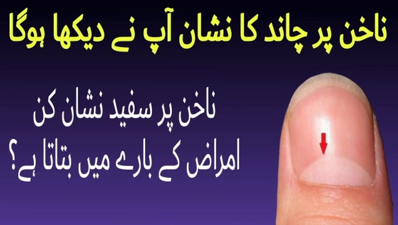 Anguthe Aur Ungliyon Par Chand Ka Nishan Nails Par Chand Ke Nishan Ka