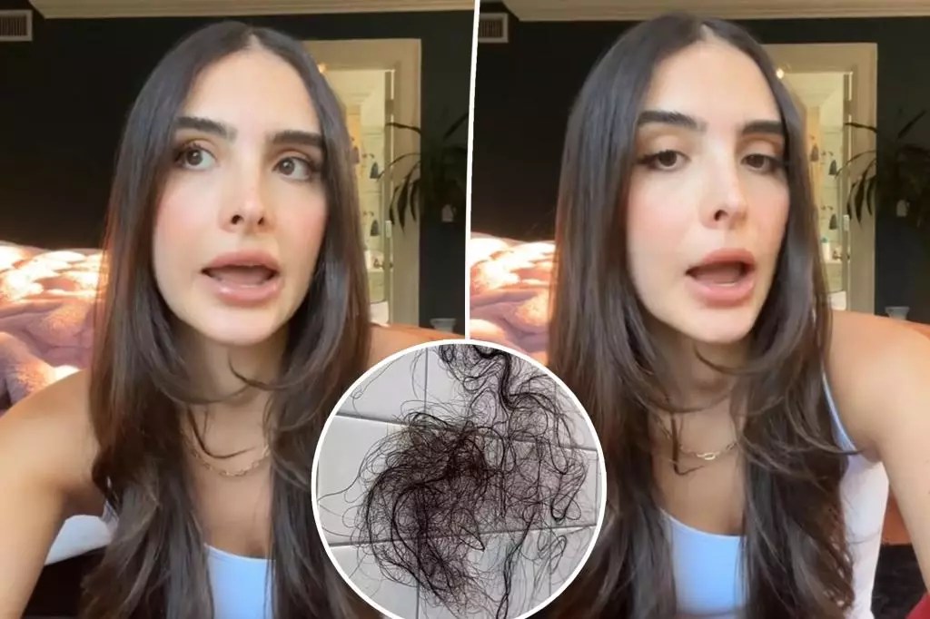 Empowerment Through Vulnerability: Sophia Umansky’s Courageous Journey with Hair Loss