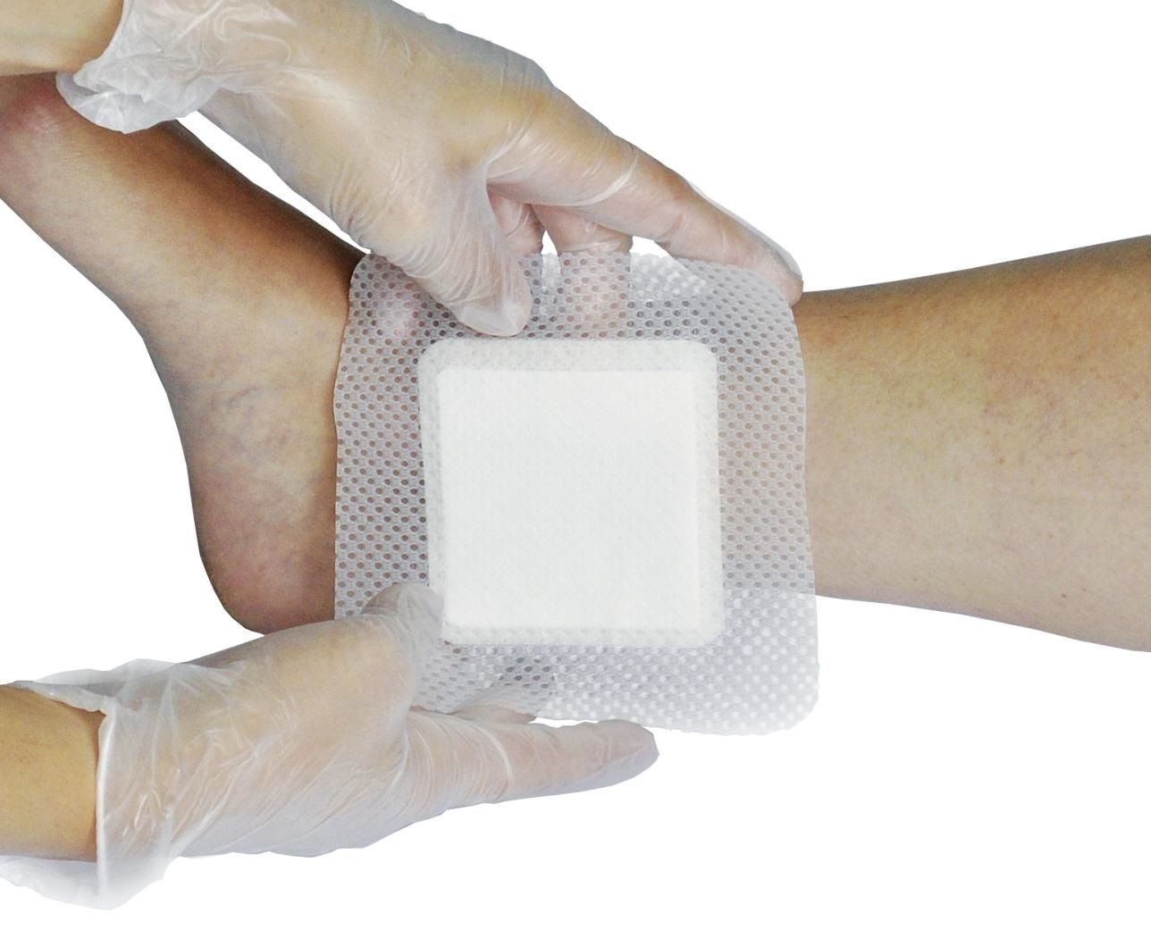 NICE new wound dressing for diabetes patients Nursing Times