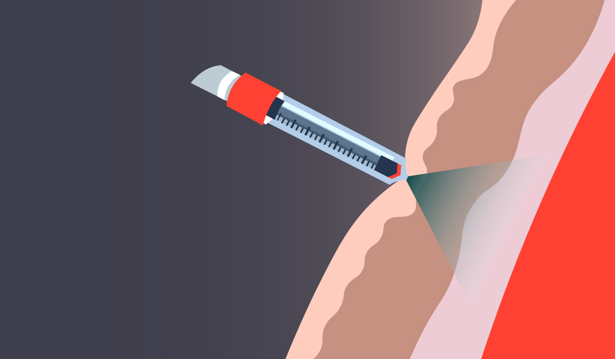 Covid 19 Vaccine Needle : Needle Free Injections Preparing For Mass Vaccination