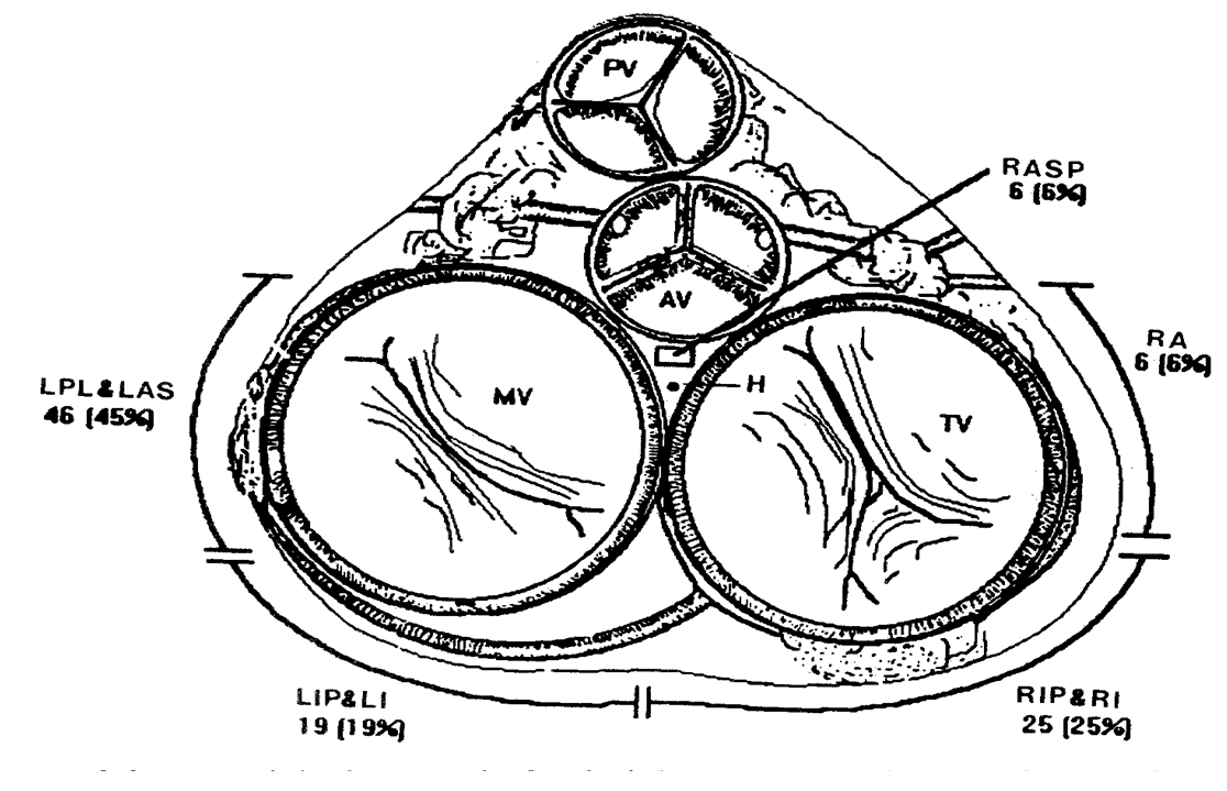 Development and evaluation of 12lead electrocardiogram in the left