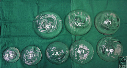 Optimal Inframammary Fold Incision Length Based on Implant Volume for