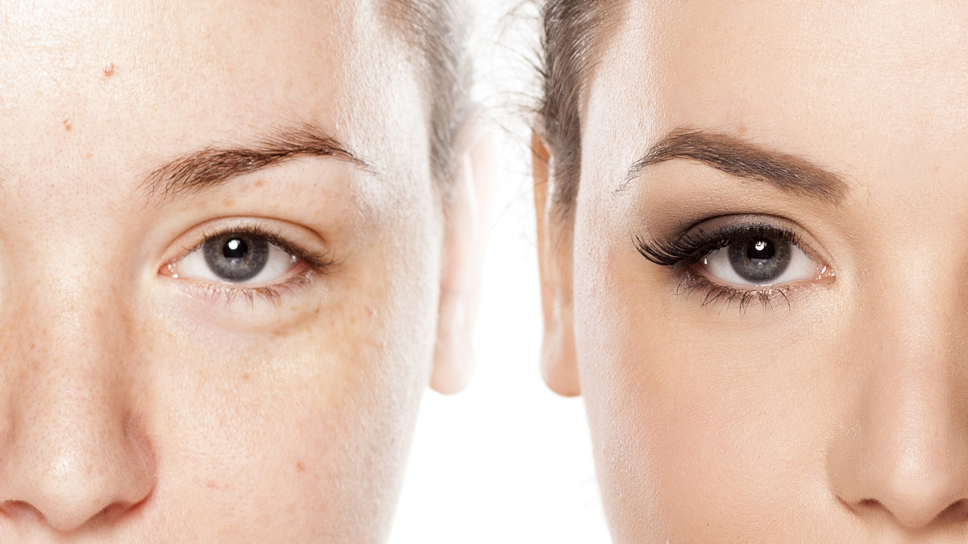 ¿Se pueden recuperar las cejas originales? Centro de ¿Se pueden recuperar las cejas originales? Centro de