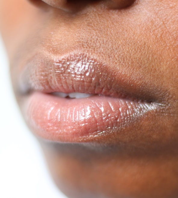 Lip Shape Overview - Causes, Treatment Options, And More | Aedit