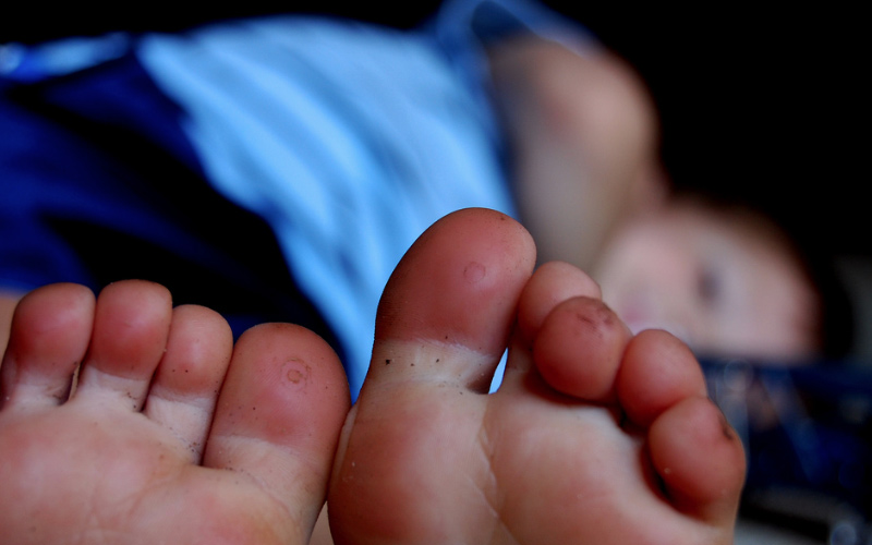 How to Prevent Blisters on Your Feet When Hiking