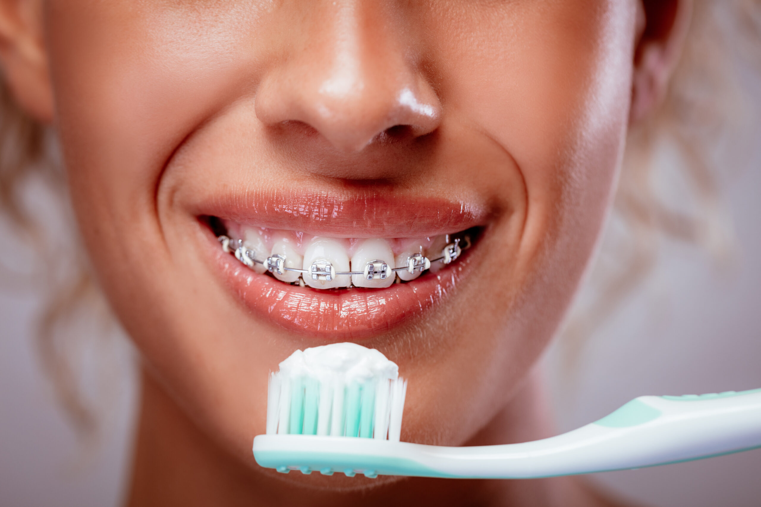 Why Treatment Times Differ with Braces Reddick Orthodontics