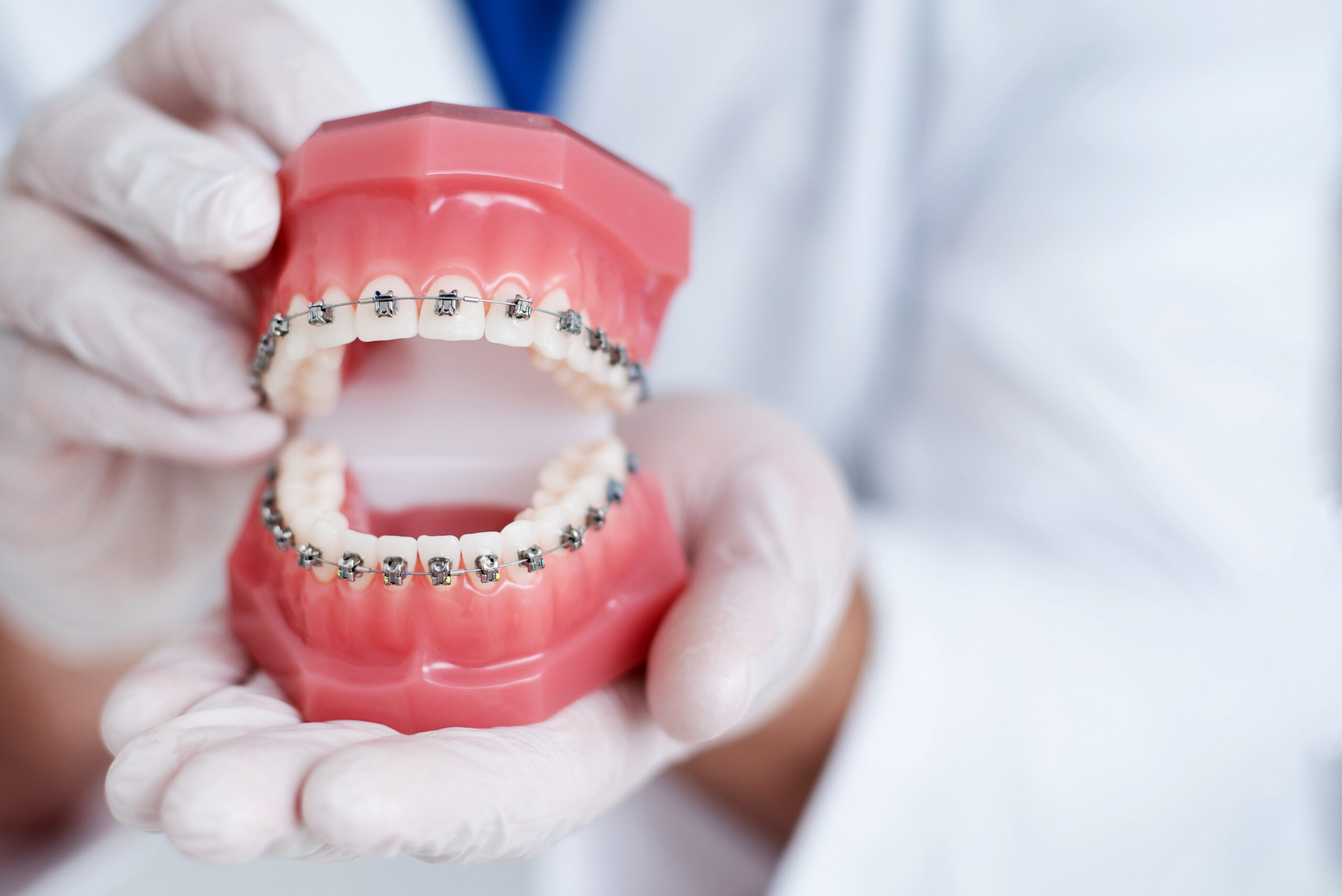 When To Get Braces Reddick Orthodontics