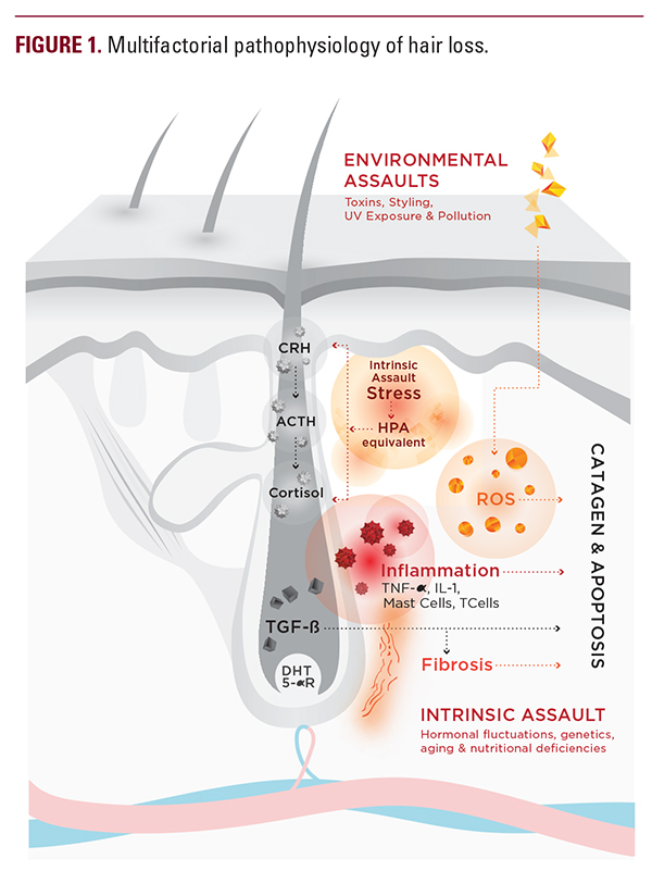 New Insight Into the Pathophysiology of Hair Loss Trigger a Paradigm