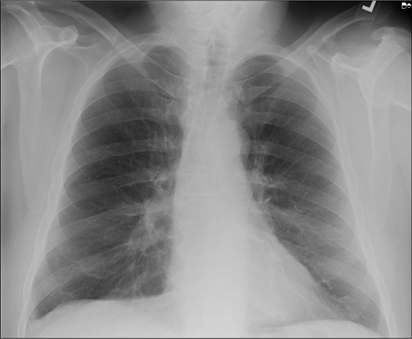 Health Benefits of Bariatric Surgery Laparoscopic.MD