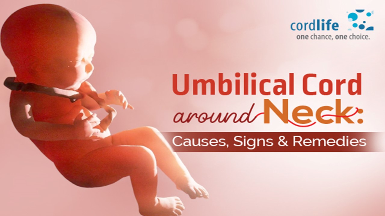 PPT Umbilical Cord Around Neck Causes, Signs & Remedies PowerPoint