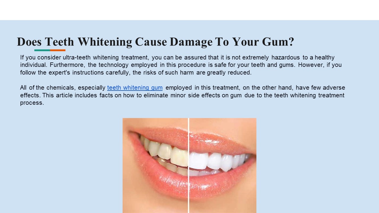 PPT Does Teeth Whitening Cause Damage To Your Gum? PowerPoint