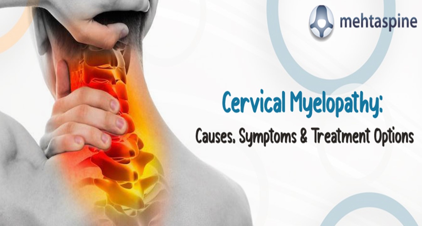 PPT Cervical Myelopathy Causes, Symptoms & Treatment Options