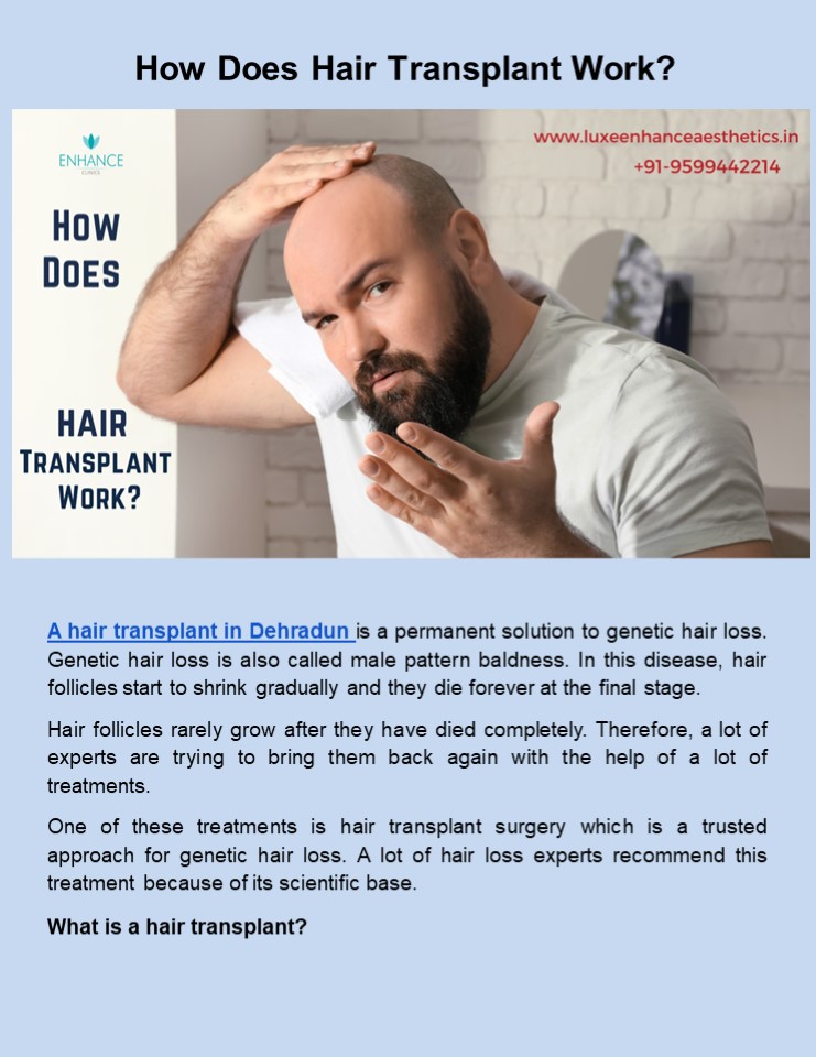 PPT How Does Hair Transplant Work? PowerPoint presentation free to