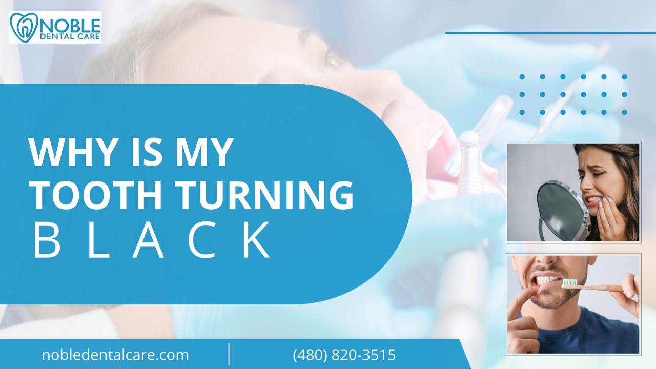 PPT Why is My Tooth Turning Black PowerPoint presentation free to