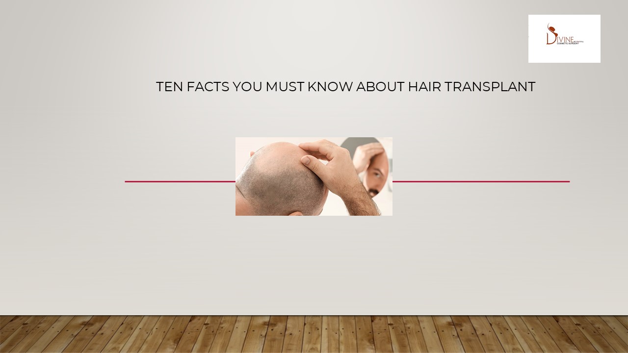 PPT Ten Facts You Must Know about Hair Transplant PowerPoint