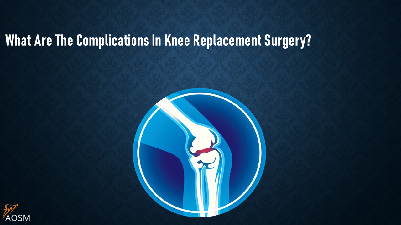 PPT What Are The Complications In Knee Replacement Surgery
