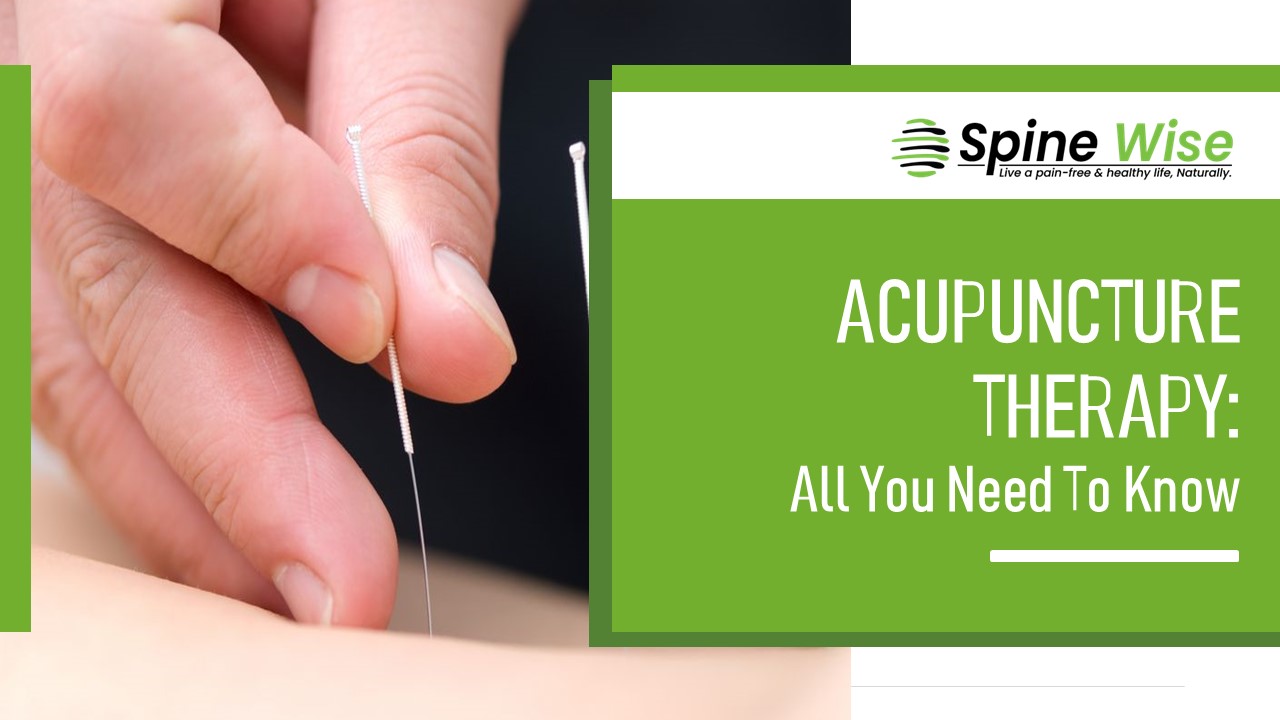 PPT Acupuncture Therapy All You Need To Know PowerPoint presentation free to download id