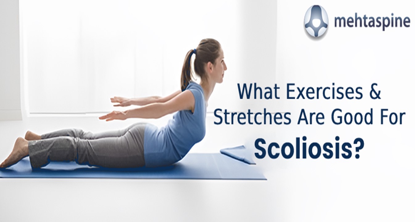 PPT What Exercises & Stretches Are Good For Scoliosis? PowerPoint