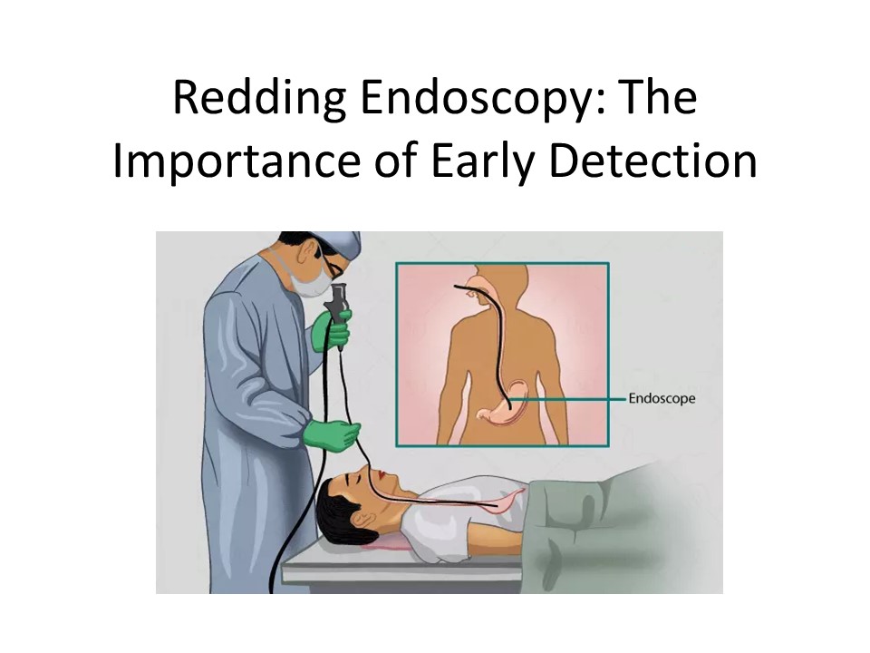 PPT Redding Endoscopy Center The Top Choice for Safe and Effective Colonoscopy Procedures