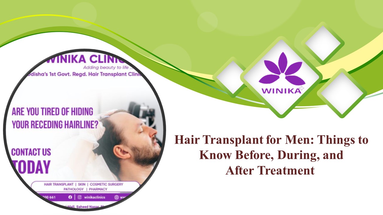 PPT Hair Transplant for Men Things to Know Before, During, and After