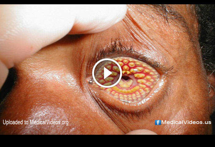 Home Ophthalmology LibGuides at Riphah International University