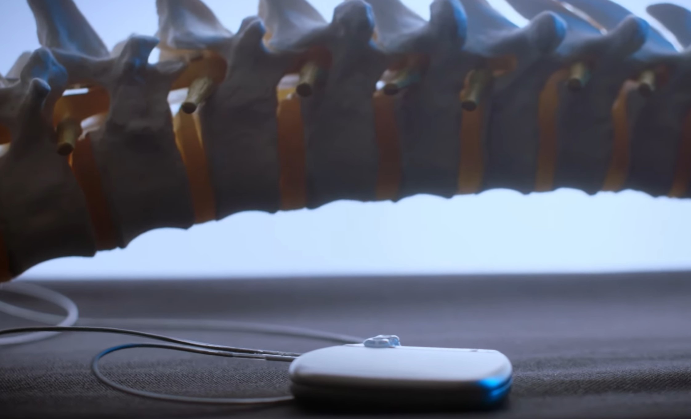 A Spinal Cord Research Breakthrough Victory Over Paralysis