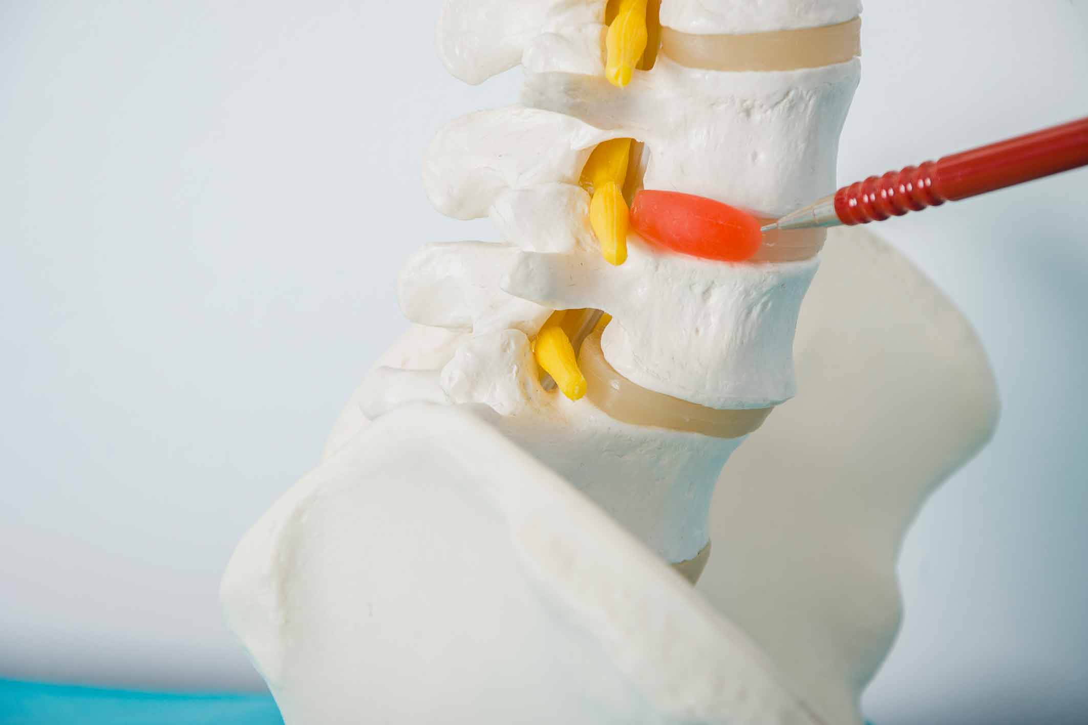 Top 3 Advantages of Spinal Cord Stimulation Therapy PainScale