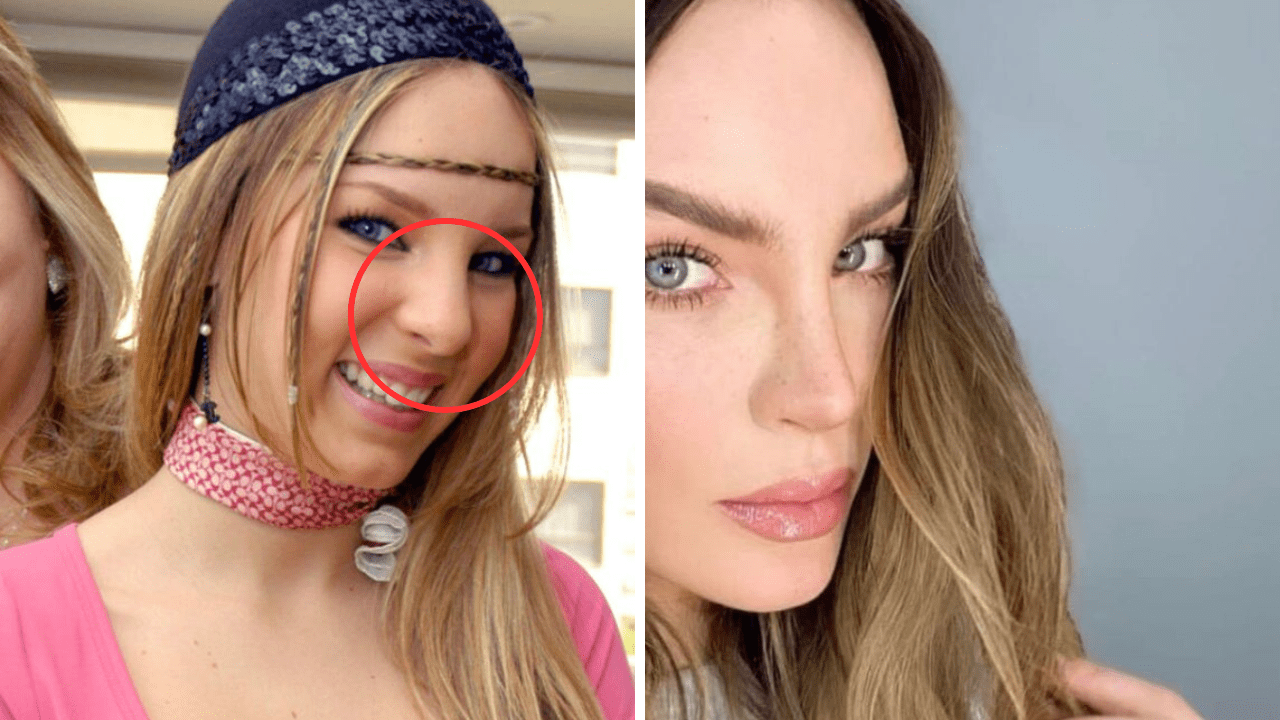 Belinda cirugías, Antes y después, así lucía la interprete de Sapito