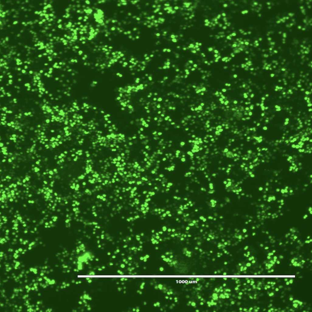 Calcium phosphate transfection mammalian cells