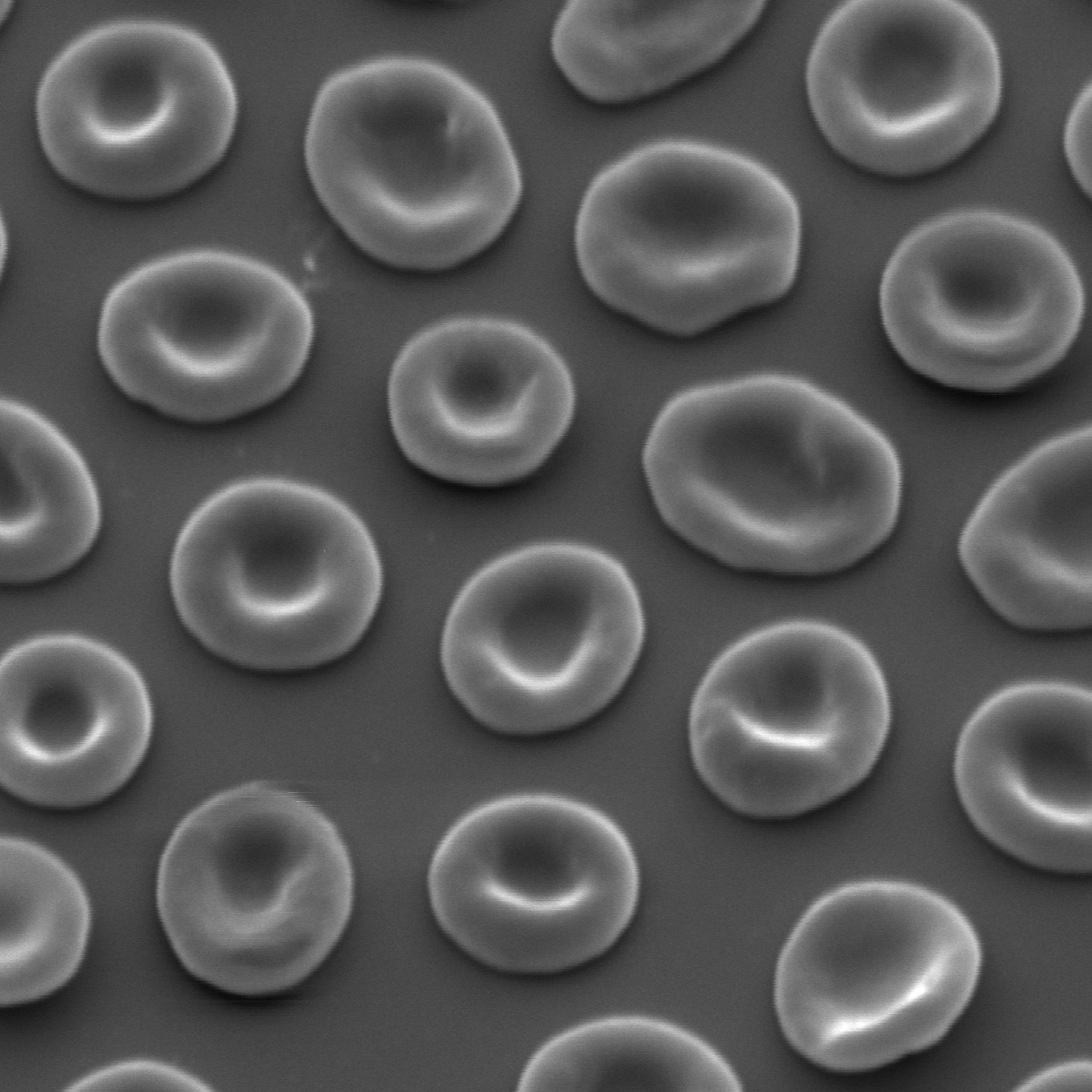 Osmolalitycontrolled fixation and simple preparation of human red