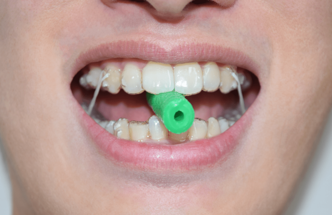 Invisalign Aligner Chewies Pack Of 20, 51 OFF