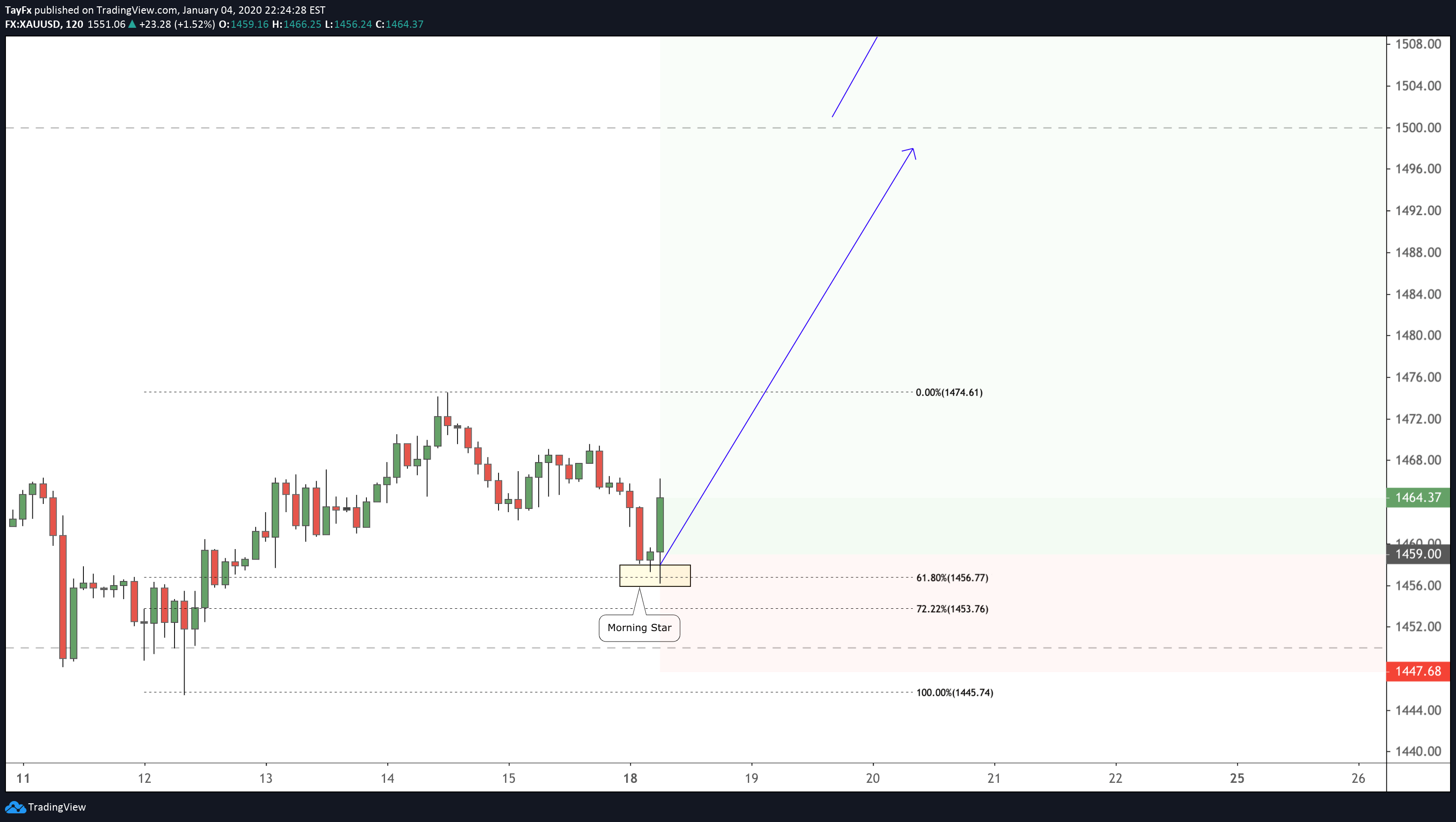Interest Rates And Forex Gold Pip Value