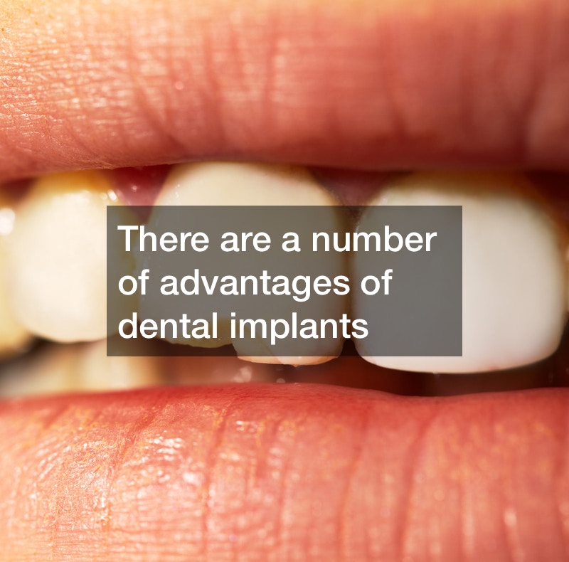 Are You Interested In Dental Implants Louisville KY? Find Dentist Reviews
