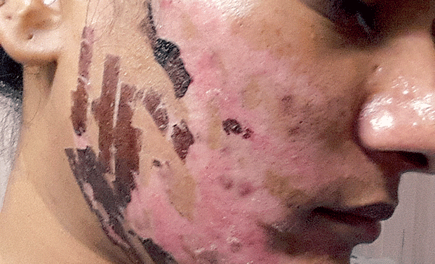 Most Indian laser therapy clinics do not follow any norms
