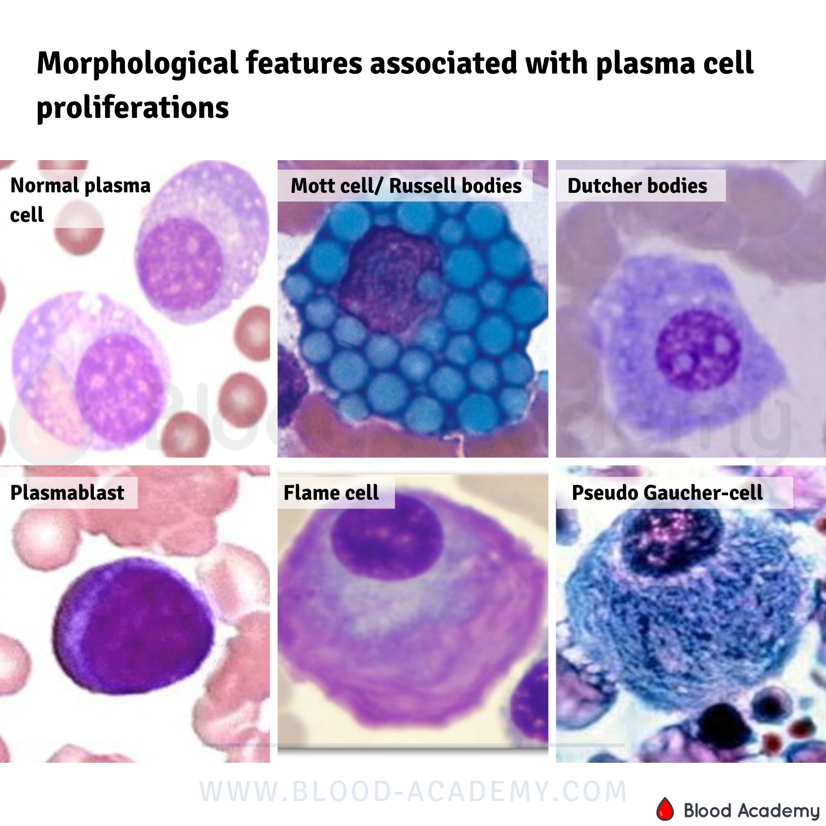 Morphological features associated with plasma cell proliferations