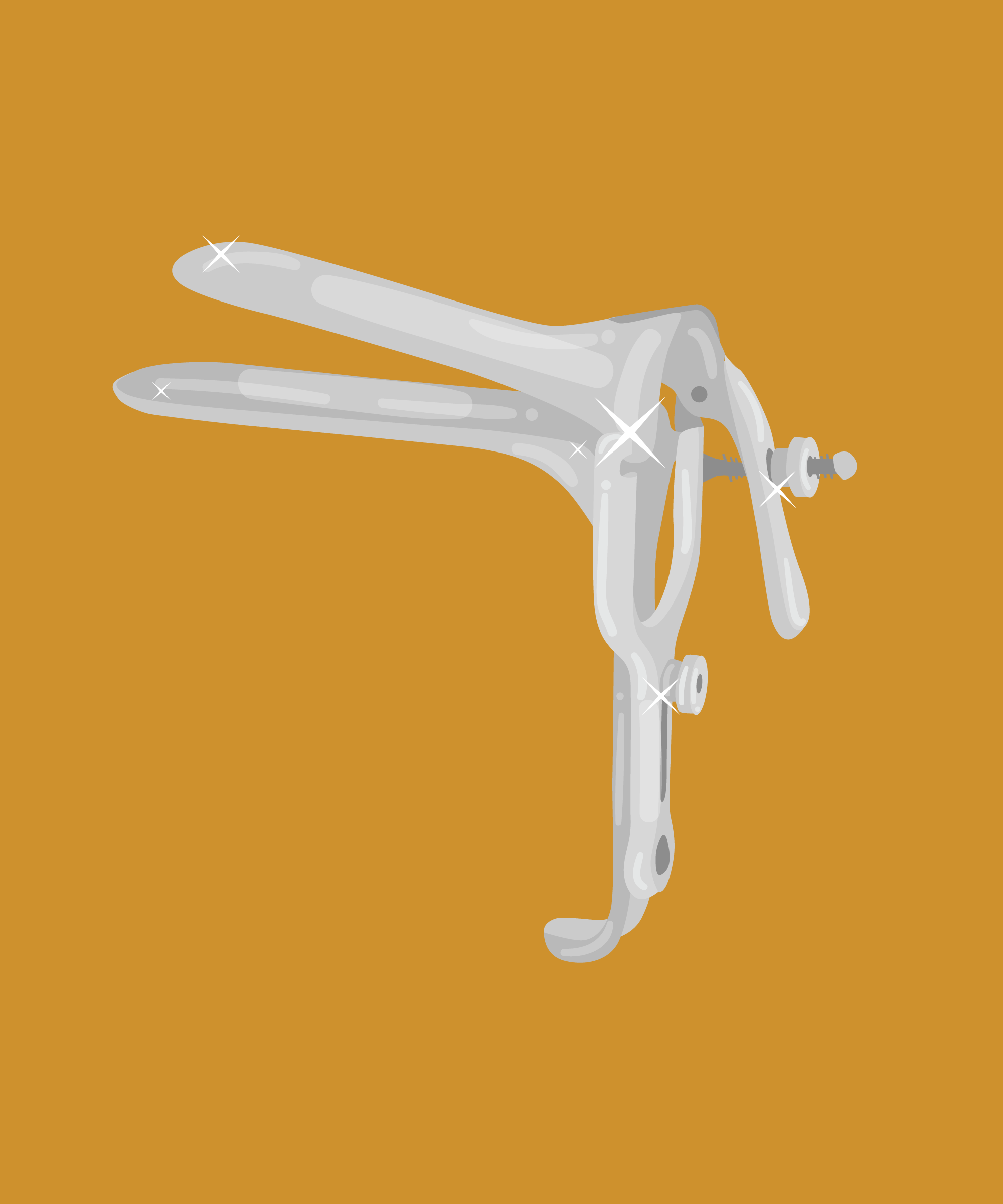 Speculum Exam Technique